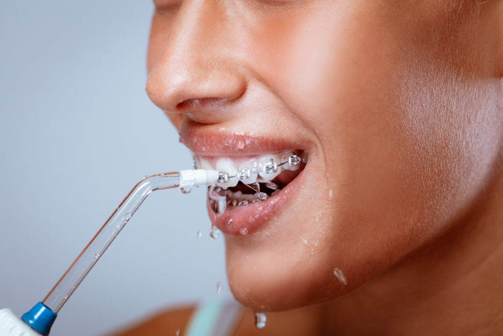 Le Waterpik, une alternative au fil dentaire 7 Femme portant un appareil dentaire et se nettoyant les dents avec un hydropropulseur dentaire, dental Geneva