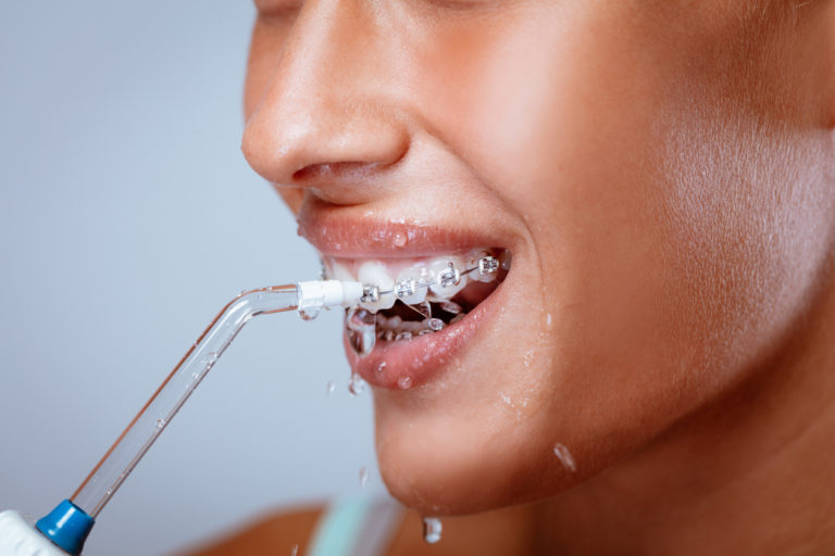 Femme portant un appareil dentaire et se nettoyant les dents avec un hydropropulseur dentaire, dental Geneva
