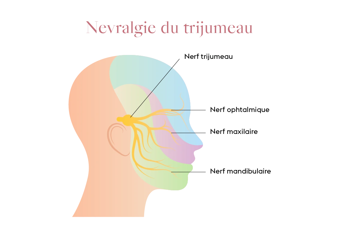Illustration anatomique du nerf trijumeau avec ses branches ophtalmique, maxillaire et mandibulaire.