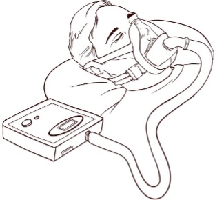 Patient wearing a CPAP mask connected to the device on the bedside table; sleep apnea treatment, possible alternative with a mandibular advancement device.