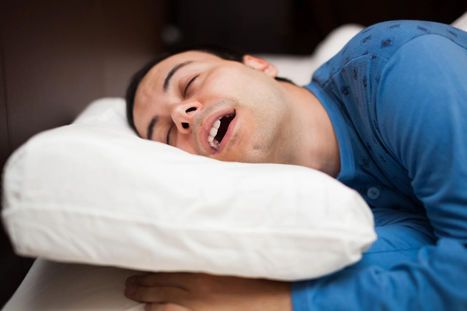 Orthèse d’avancée mandibulaire sur mesure : deux gouttières bi-maxillaires reliées par un mécanisme d’avancement, utilisée pour réduire le ronflement et l’apnée du sommeil légère à modérée.