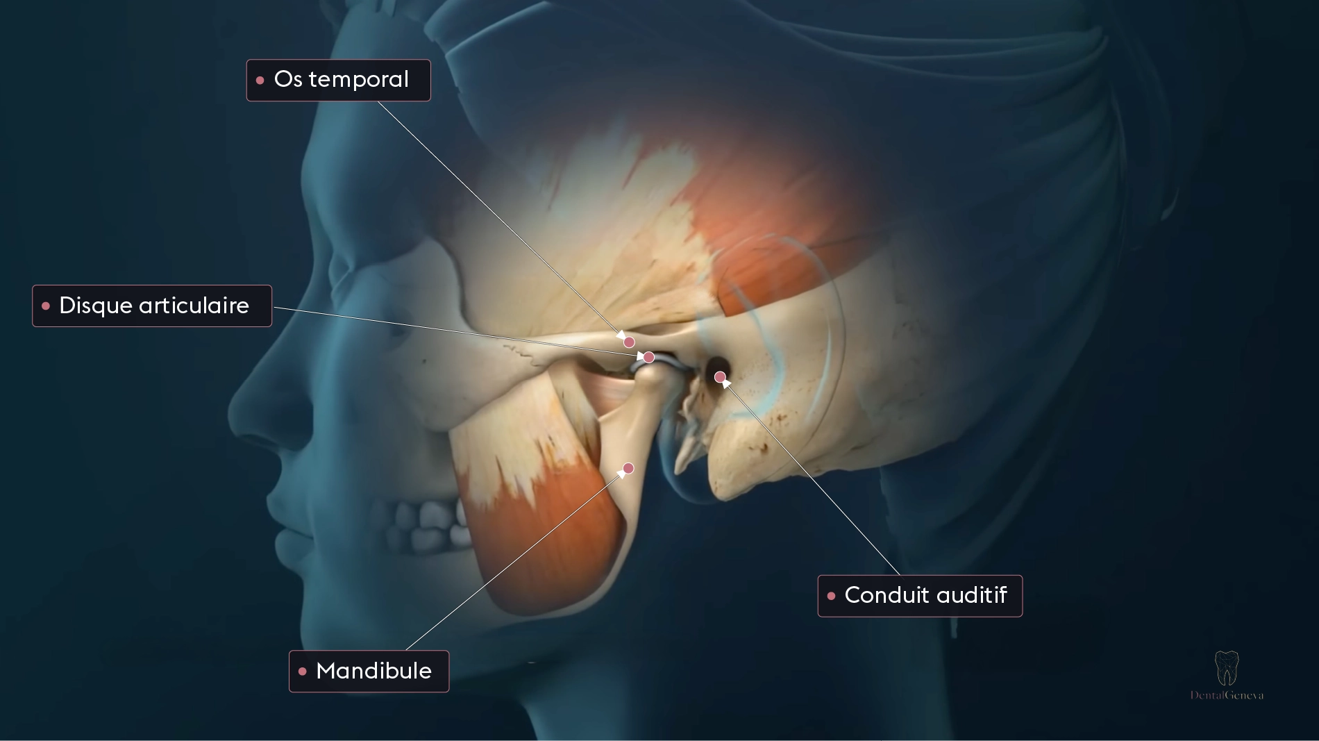 Schéma de l'articulation temporo-mandibulaire montrant le condyle, le disque articulaire et les muscles masticateurs.