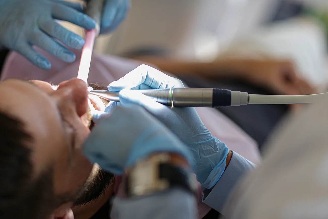 Scaling at the Dental Geneva clinic near Cornavin station in Geneva, the first step of gum treatment.